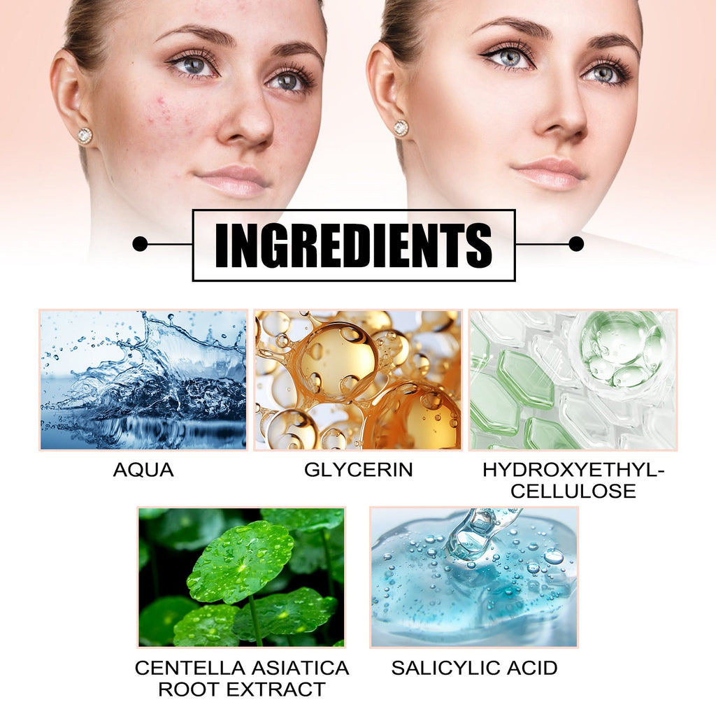 Acne Removal Protection Defense Patch, Color Profile-shaped Portable Invisible Cover Acne Patch