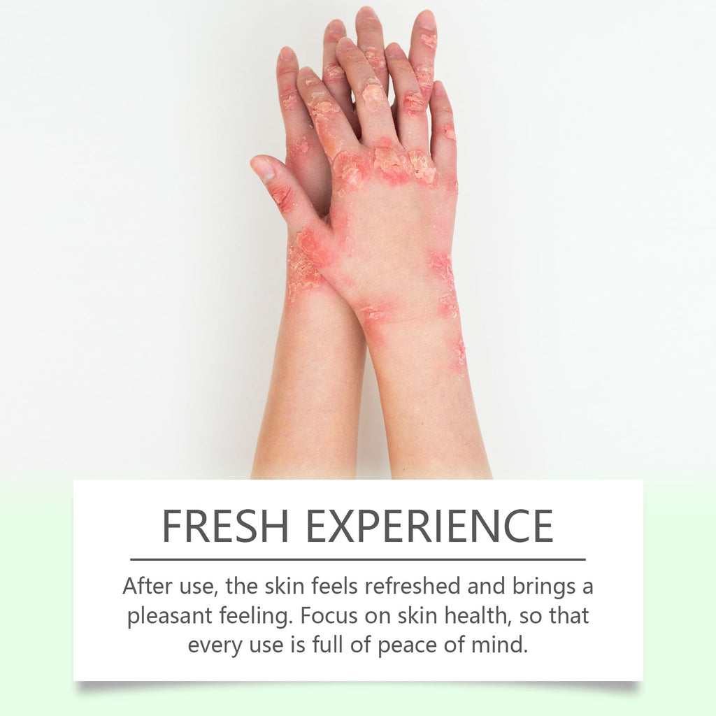 Herbal Skin Soothing Cream That Soothes And Nourishes Uncomfortable Skin With Body Skin Treatment Cream