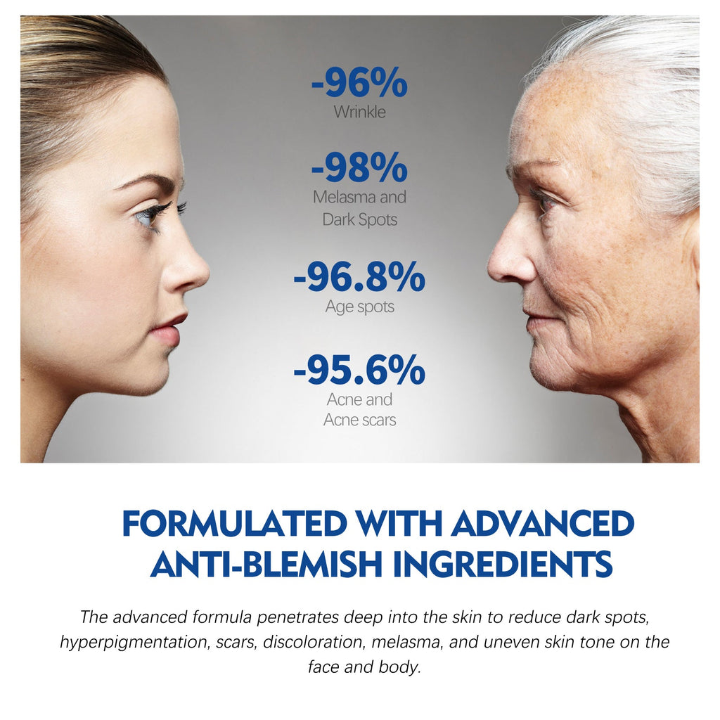 Dark Spot Repair Essence, Repair Acne Pimple Lightening Spot Fine Lines Moisturizing Firming Whitening Essence