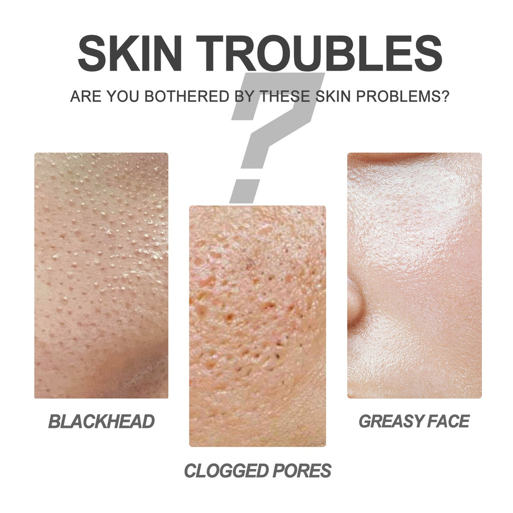 Deep Purifying Pore Banishing Kit, Pore Thinning And Blackhead Remover Moisturizing Essence