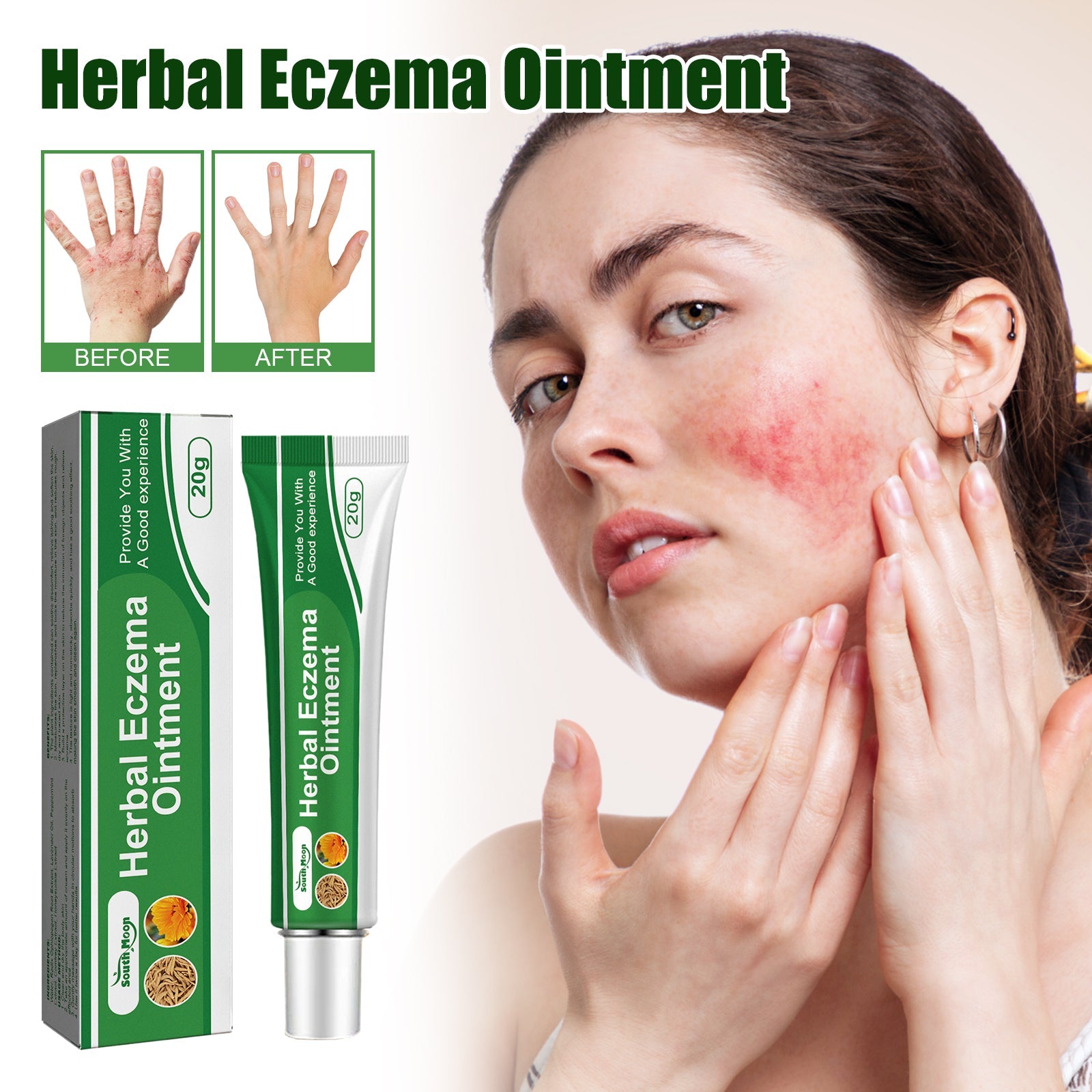 Herbal Eczema Ointment, Relieve Hand And Foot Moss Skin Redness Itchy Skin Repair Ointment
