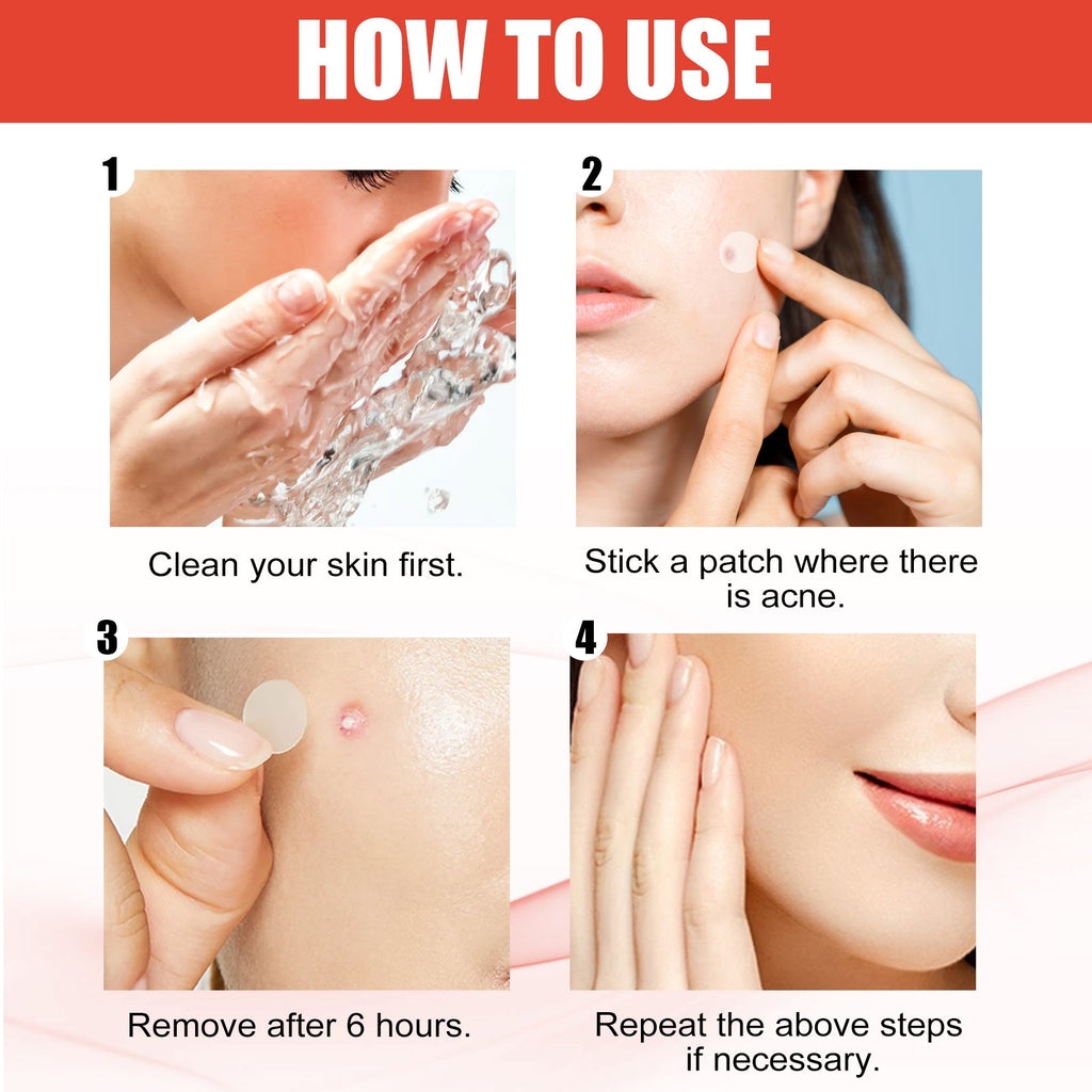 Hydrocolloid Acne Patch Face Invisible Makeup Closed Mouth Acne Clear Acne Waterproof Breathable Facial Treatment