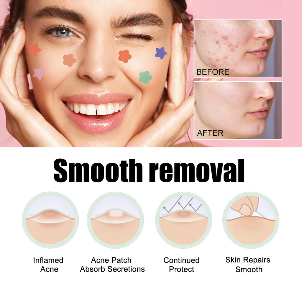 Acne Removal Protection Defense Patch, Color Profile-shaped Portable Invisible Cover Acne Patch