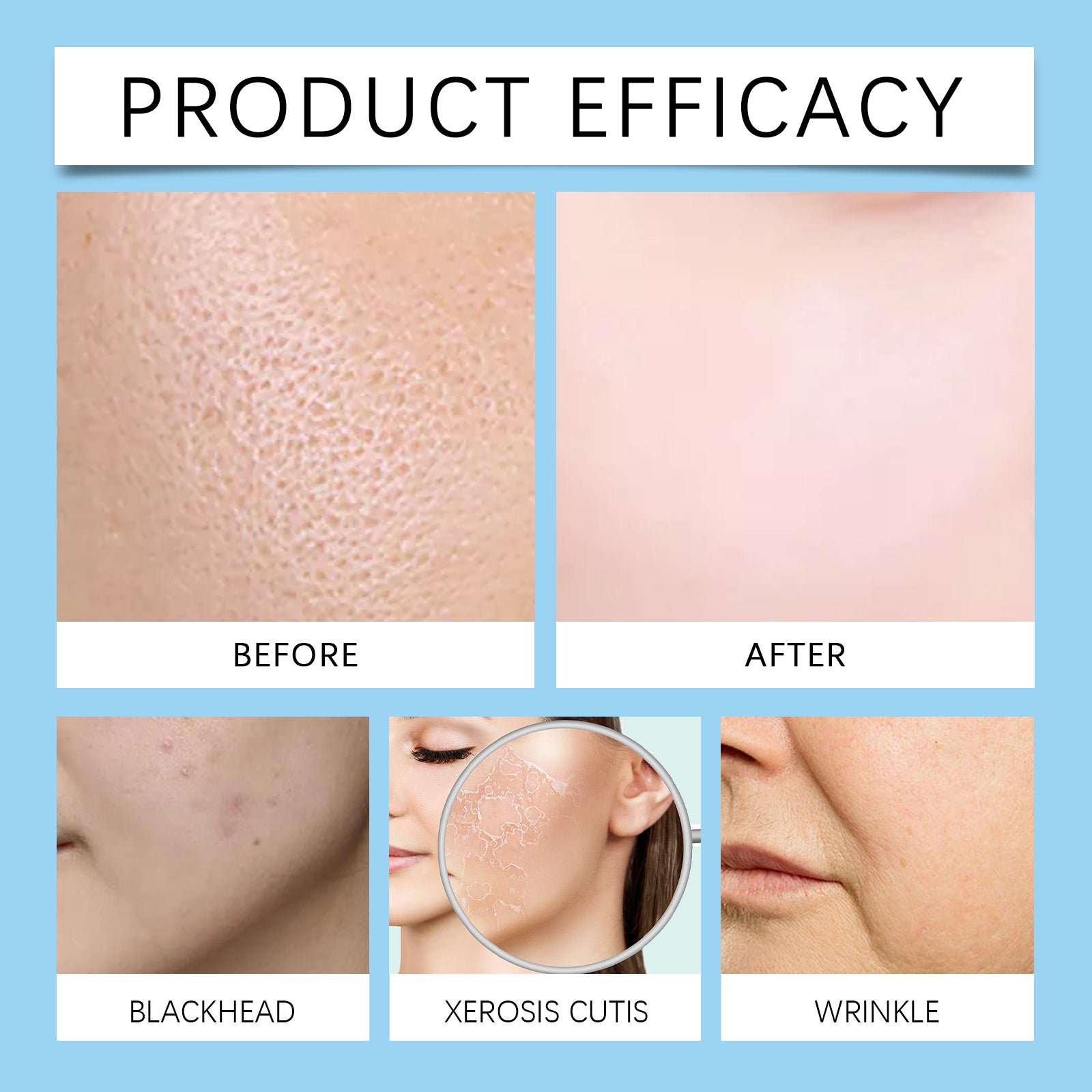 Hyaluronic Acid Stock Solutions, Improve The Skin Pores Hydrating Facial Luster