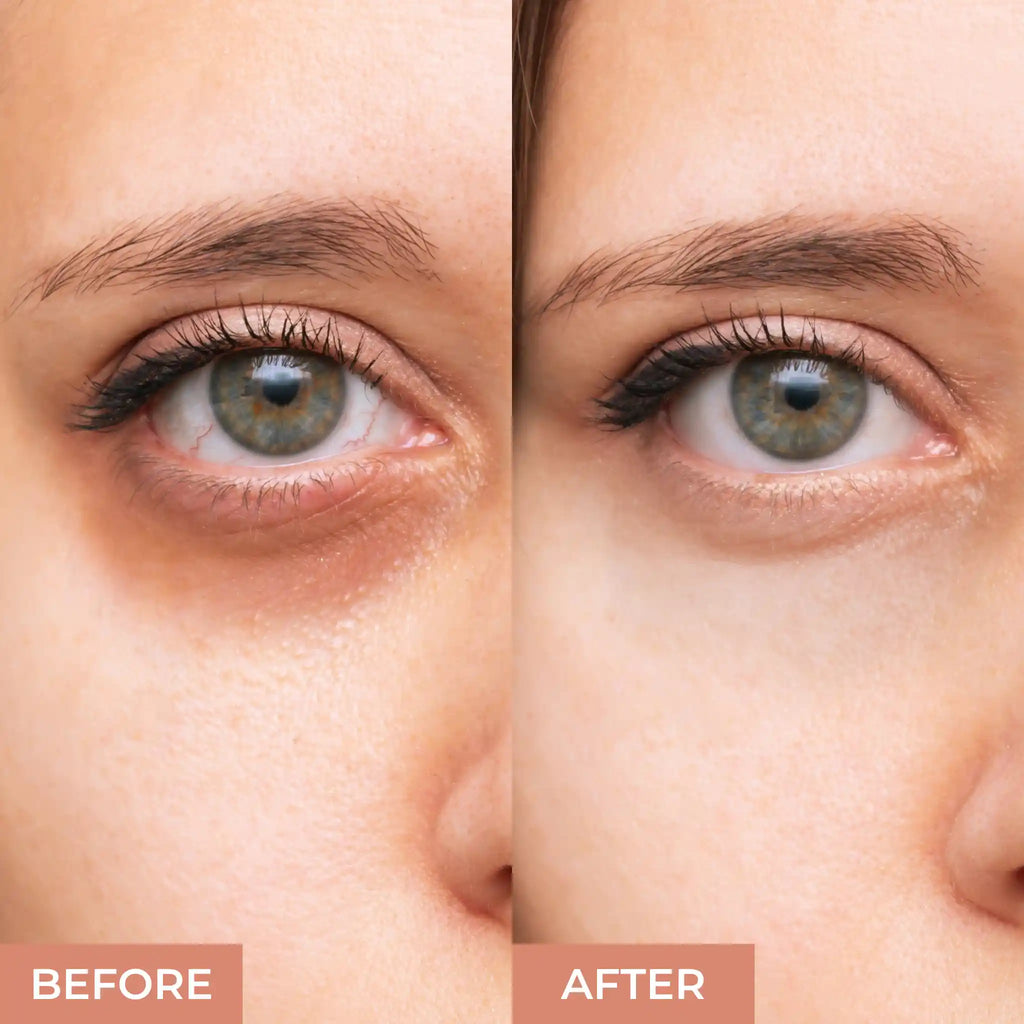 Prolux Concealer For Dark Circles